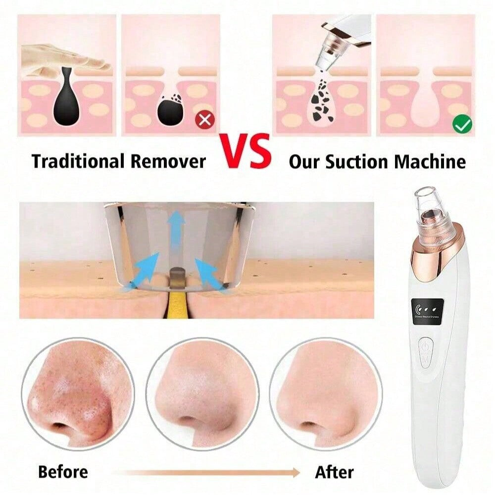 UBA™ – Electric Acne Pore Cleaner & Blackhead Remover